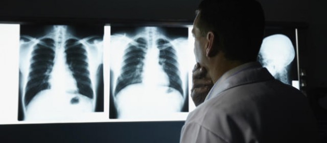 Radiología, curar desde el anonimato